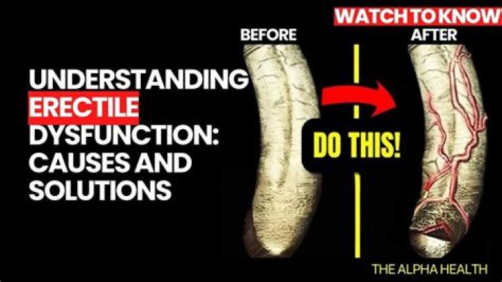 Salt Under Tongue and Erectile Dysfunction: The Surprising Connection You Need to Know